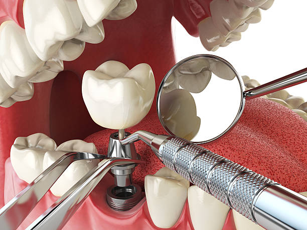 Best Emergency Denture Repair in Occoquan, VA